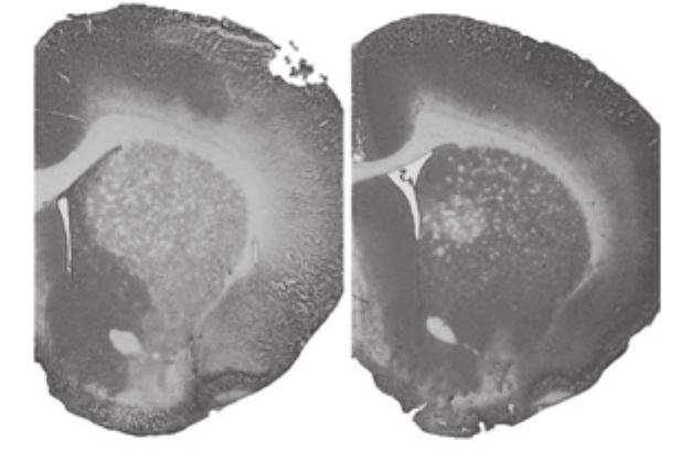 There are many NeuN-positive cells in Normal (a) and Ex. group (b), compared to group (c).