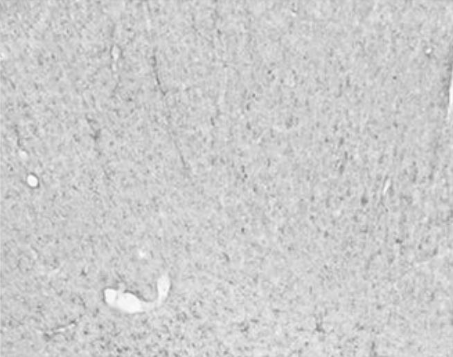 group (B) (scale bar, 100 µm). =middle cerebral artery occlusion; Ex=exercise; VEGF=vas-cular endothelial growth factor. 논의 뇌안의모세혈관을통한산소의확산은신경세포의에너지대 사를위한매우중요한단계이다.