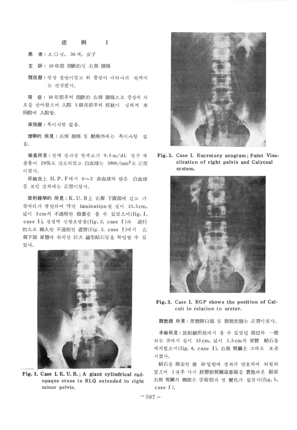 :JÆ 例 I 愚 者 : 오 O 녕, 36 세, 女子 主訴 10 年間 f 돼歐的인右떼 l 댔痛 얹往歷. 정상분만이었고위증상이나타나기전까지 는건캉했마. 現 1ff.: 10 年前부터間歐따右떼體痛으로증상적치 료를받아왔으며 A 院 5 個月前부터 1JË 狀이 섬해져 本 病院에入院함. 家族歷 특이사항없음 理學的所見. 右페體痛및많痛外에는특이사항없 p. 檢훌所見.