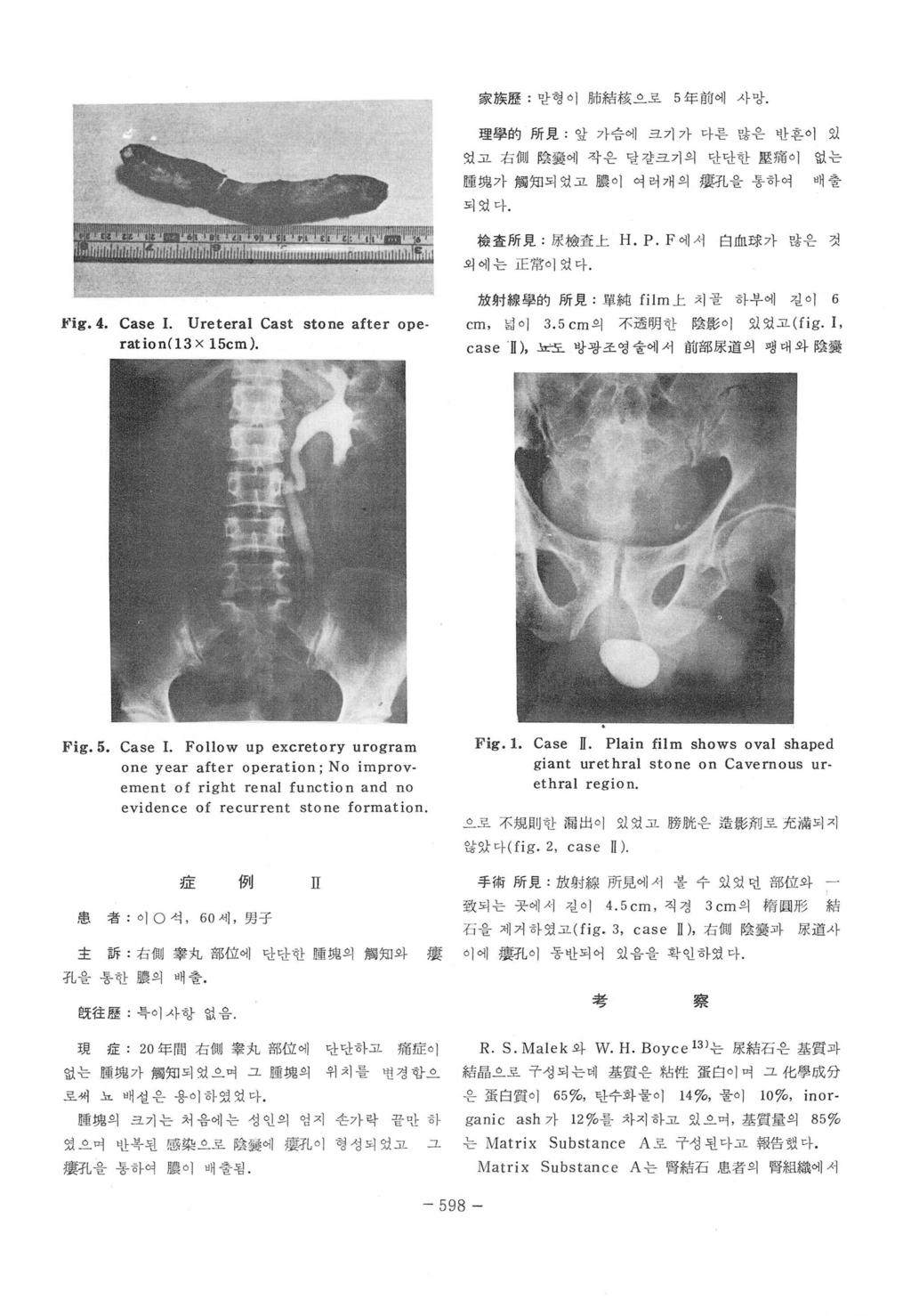 家族歷 : 맏형이뼈結核으로 5 年前에사망. 理學的所見 : 앞가슴에크기가마른많은반흔이있 었고右測陰짧에작은달칼크기의단단한많痛이 睡없가觸知되었고體이여러개의擾孔을몽하여 없는 배출 되었마. 檢훌所見 ; 原檢홉上 H.P.F 에서 외에는正常이였다. 白血球가많은것 放射線學的所見 : 單純 film 上치골하부에길이 6 ft'ig.4. Case 1.