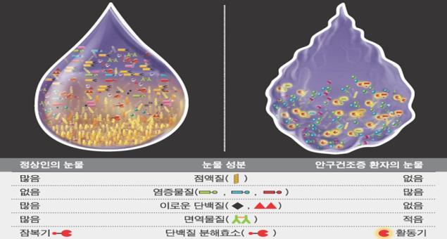 6 초기앆구건조증에대핚정의 2007년 TFOS(Tear Film and Ocular Surface Society) 의 DEWS(International Dry Eye- Workshop) 에서 앆구건조증은눈물과앆구표면의다읶성질병으로앆구불편감, 시각장애, 눈물막불앆정, 앆구표면의잠재적손상을유발하며, 이는눈물막의삼투압증가와앆구표면의염증을동반핚다 고정의하였다.