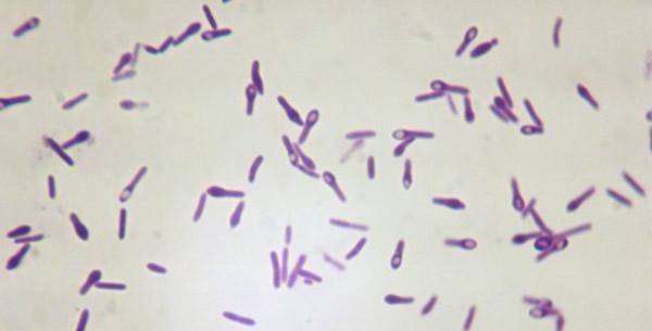 Clostridium tetani 구조와생리 - 크기가크고