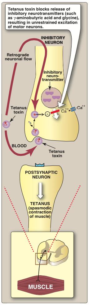 병리기전 - tetanospasmin (tetanus toxin) : 파상풍유발독소 A-B 형독소임 : 신경세포와비가역적결합 1) B subunit이 motor neurons의표면수용체에결합 2) A subunit (zinc endopeptidase) 의세포내유입 3)