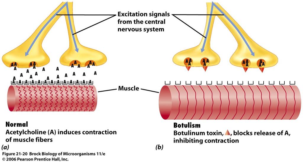 The action of botulinum toxin from Clostridium botulinum.