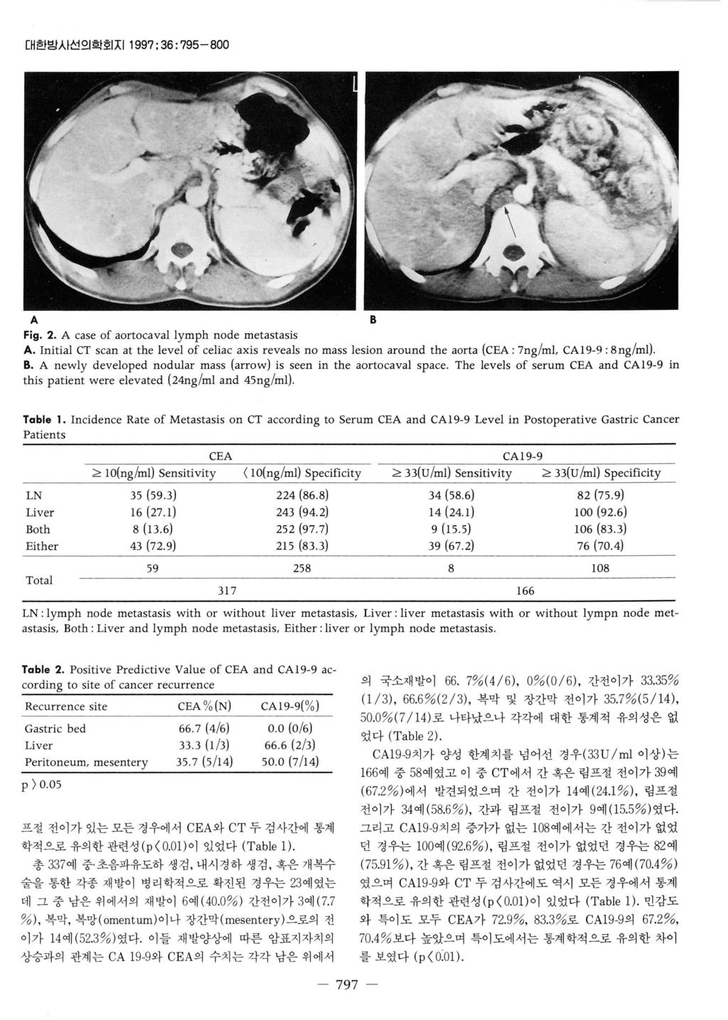 대한밤시선의학호 IX11997; 36: 795-800 A B Fig. 2. A case of aortocavallymph node metastasis A.