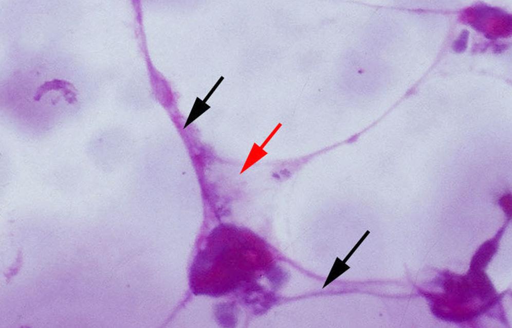 8 실모양각막염에대한원인별분류및치료에대해서국내보고가선행된바있으나 7 단순건성각결막염에의한실모양각막염보다각막의폐쇄에의한실모양각막염이치료에잘반응하지않는이유에대해알려진바가없다. 이에본연구에서는건성각결막염과비교하여각막의폐쇄에의한실모양각막염의병리학적특징을알아보고효과적인치료법을모색하고자하였다.