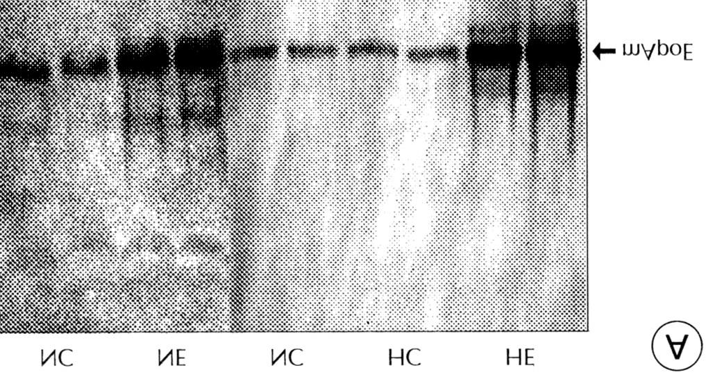 AST/ALT in plasma of PBS-injected mice and recombinant virus rad.mapoe injected mice Weeks after AST IU/L ALT IU/L injection PBS injected Virus injected PBS injected Virus injected 0 36.6310.42 38.