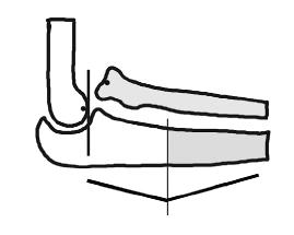 Point a: Anterior portion of the spherical surface of the capitellum.