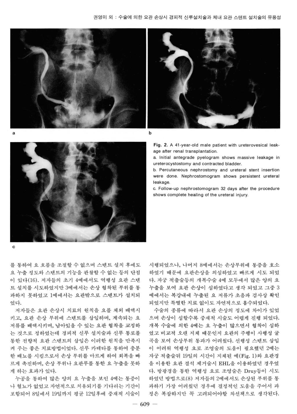 권영미오 I : 수술에의한요관손상시경피적신루설치술과체내요관스텐트설치술의유용성 a b Fig. 2. A 41-year-old male patient with ureterovesical leakage after renal transplantation a.