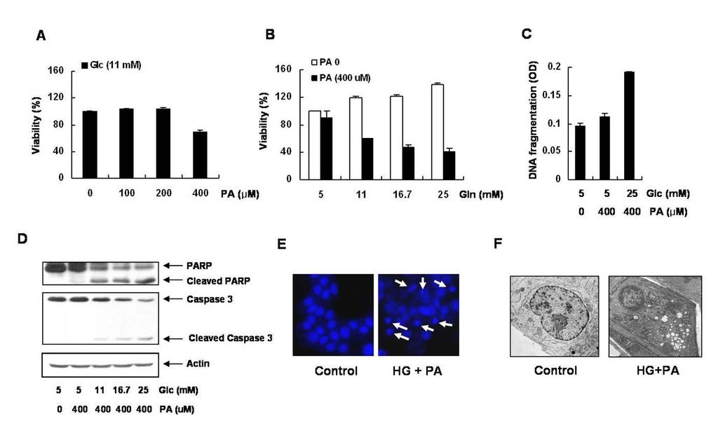 Fig. 5. HG/PA-induced INS-1 beta cell death INS-1 cells were pretreated with different concentration glucose for 30 mins before adding 400 μm palmitate.