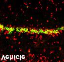 39;3 days-mmp-9 inhibitor, 747.62±99.36 * ;unpaired t-test, *p<0.