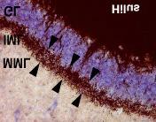 Vehicle MMP-9I * * Control CA 1 CA 3 B Relative functional unit Caspase-3