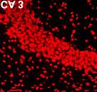 Zinc 를함유 하는이끼섬유는 Timm s staining 상에서암갈색을나 타내며, DG granular cell 과 CA pyramidal