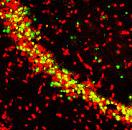 Reduction of DNA fragmentation and caspase-3 activity after pilocarpine-induced