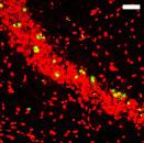 A:Comparison of TUNEL staining in hippocampal subfield CA1 and CA3 among normal