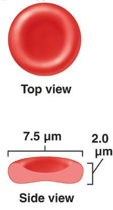 spherocytosis ( 구상적혈구증 ), hereditary elliptocytosis