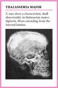 02, female 14.02); Hematocrit < 37% ( 정상치 : male 47.