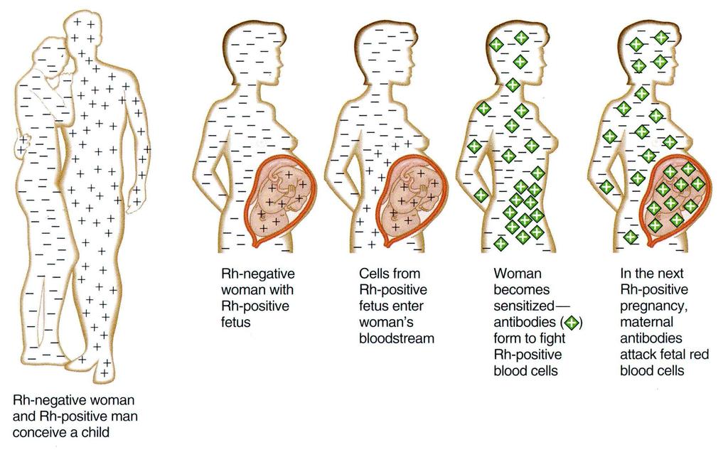 Rh - mother w/rh - baby- no problem Rh + mother