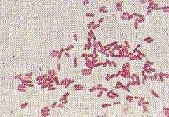 간균 Agrobacterium
