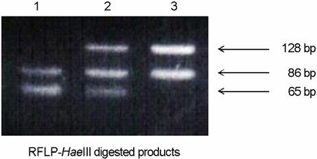 제 35 권제 2 호, 2008 김민지 이형송 최혜원 임천규 조재원외 3 인 Table 2. Preclinical single-cell PCR analysis with single lymphocytes in osteogenesis imperfecta Case 1 Case 2 Amplification rate 94.2% (49/52) 98.