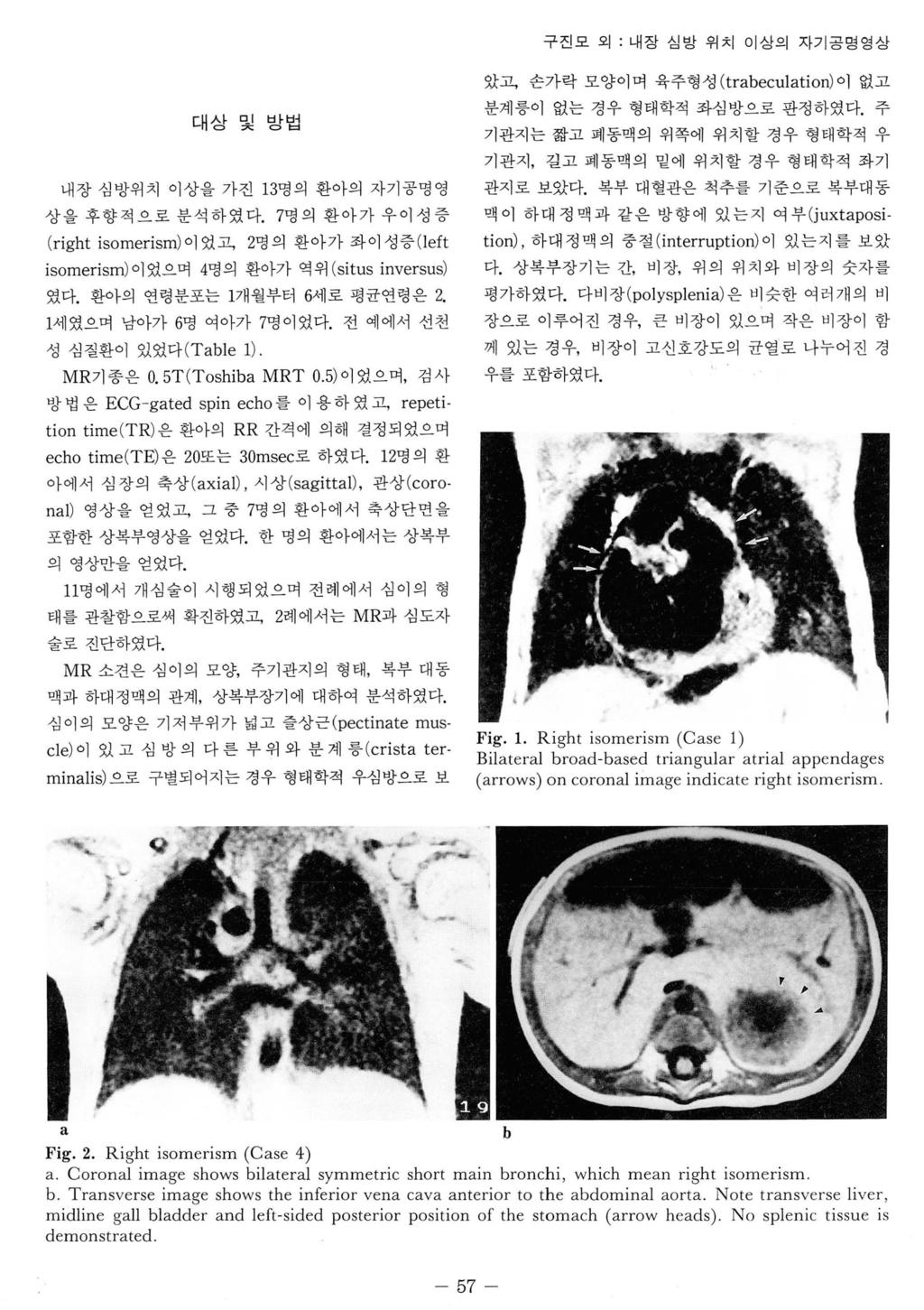 구진모외 : 내장심방위치이상의자기공명영상 대상및방법 내장심방위치이상을가진 13 명의환아의자기공명영 상을후향적으로분석하였다. (right isomerism) 이었고, 7 명의환아가우이성증 2 명의환아가좌이성증 (J eft isomerism) 이었으며 4 명의환아가역위 (situs inversus) 였다. 환아의연령분포는 1 개월부터 6 세로평균연령은 2.