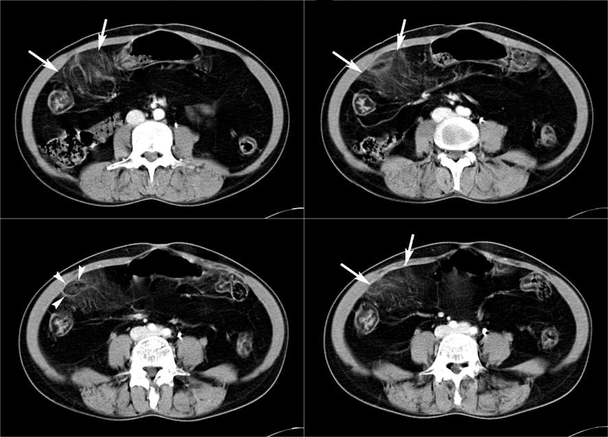 - The Korean Journal of Medicine: Vol. 76, No. 4, 2009 - C D Figure 1.