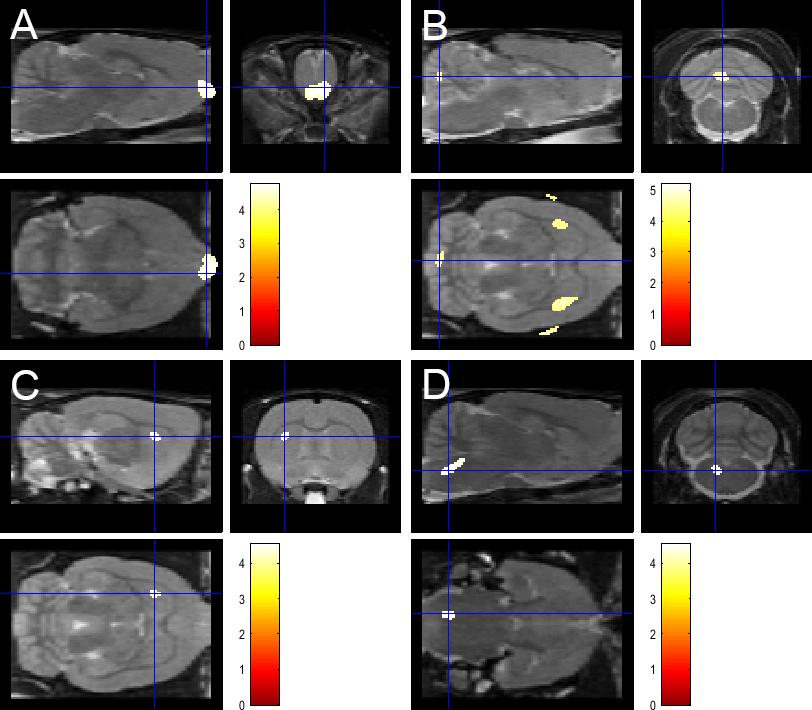 Figure 4. Statistical parametric mapping revealed altered brain activity by VPA treatment.