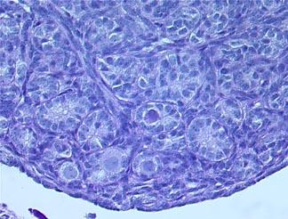 Ovaries from wild type and Nobox null (Nobox-/-) mice at postnatal day 1, 7, and 14.