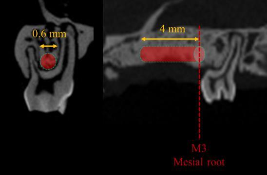 morphometry of the tibia.