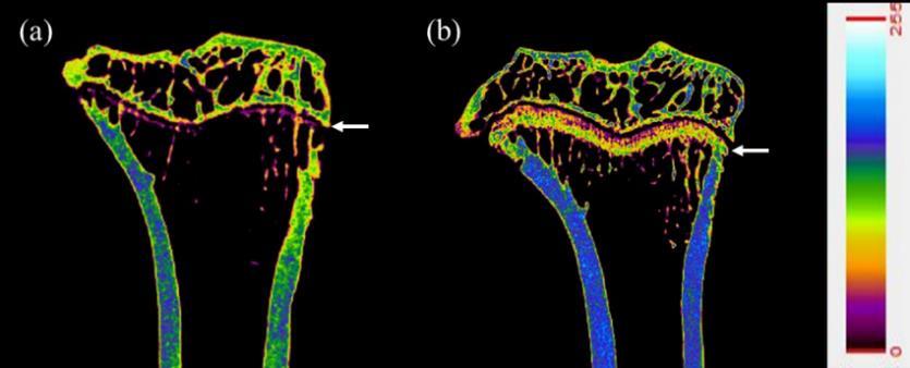 (A, anterior; P, posterior) Figure 6. Micro-CT images of the tibia. Two-dimensional colored ex vivo micro-ct image of proximal part of tibia.