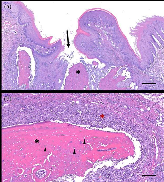 Figure 11. Histologic analysis in the extraction site of ZA group. Delayed healing of epithelium (black arrow) and necrotic bone under the lesion (black asterisk) are observed in (a).