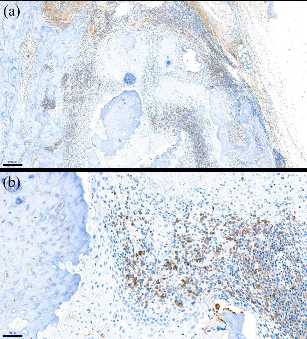 Figure 13. Immunohistochemical staining for anti-cd68 (a, b) in ZA group.