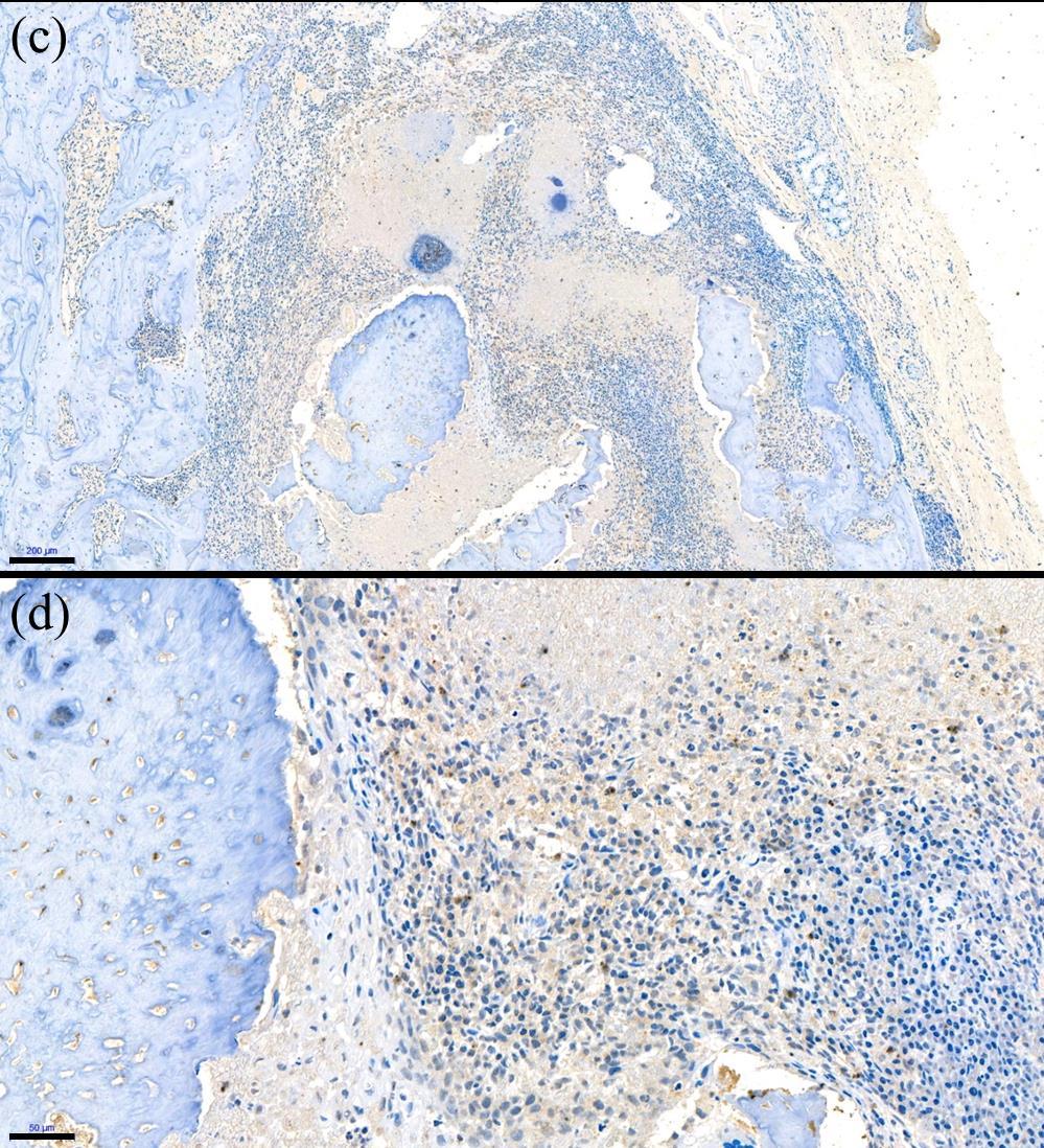 Figure 13. (continued) Immunohistochemical staining for anti-cd86 (c, d) in ZA group.