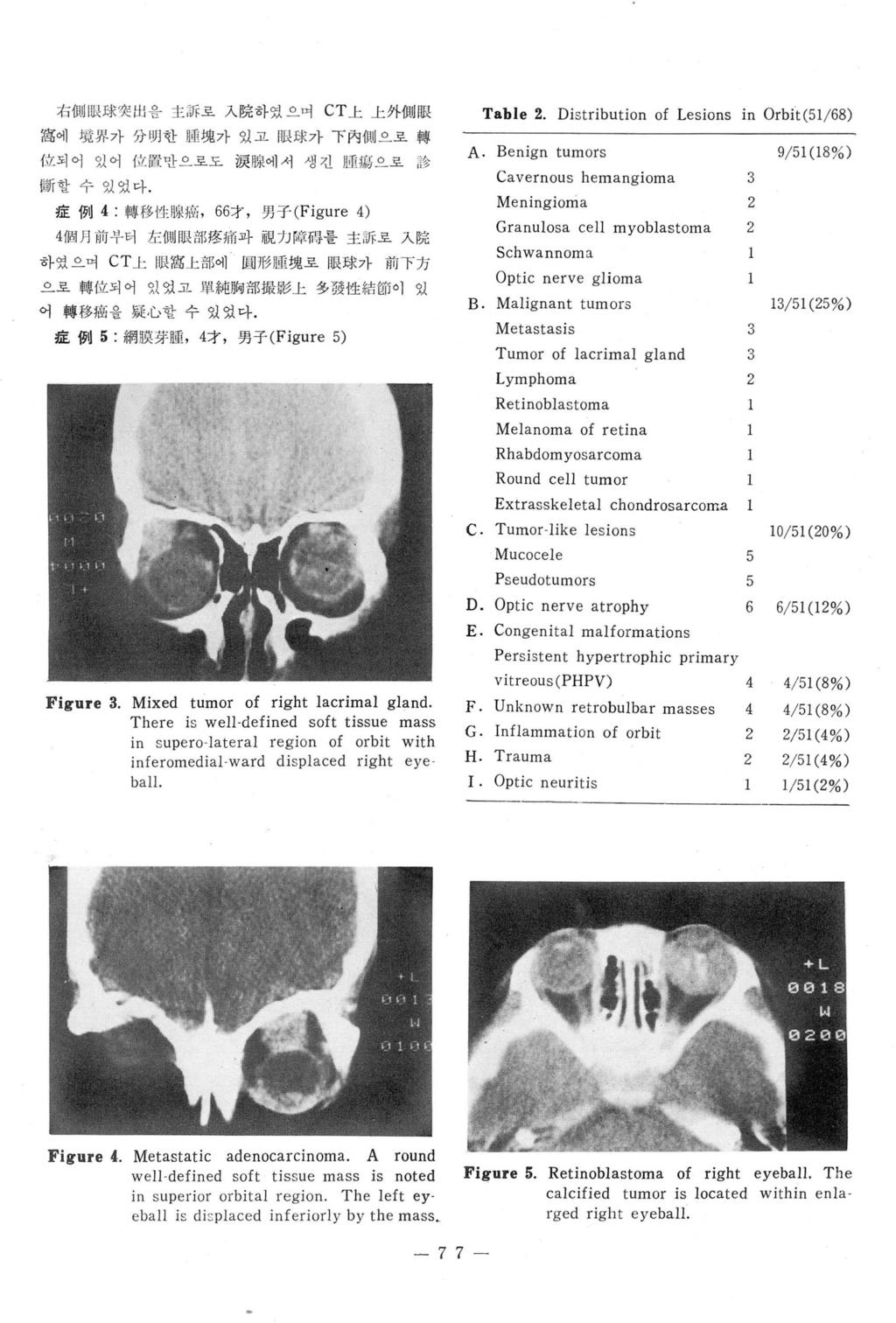 右떼 l 싸 I 求突 w 을主?Jí' 호入院하였으며 CT 上上外 ~!1j1lR 홈에양 UR- 가分 l 꺼한빠塊가있고 nμ J;J< 가下內 11 씨으로轉 位되어있어 Í''l. [ i 만으로도淚 많에서생긴 li ill 찌으로 ~~ 修 f 할수있었마.