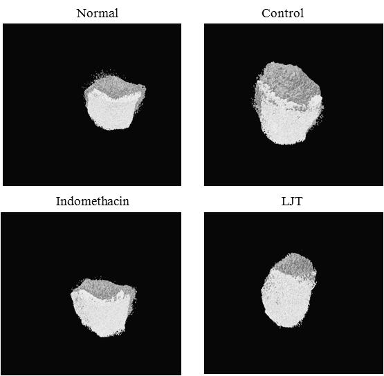 국길호 오민석 5 Cartilage volume(mm 3 ) 4 3 2 1 0 Normal Control Indomethacin LJT Fig. 16. Effects of LJT on cartilage volume using micro CT-arthrography in joint tissue of MIA-induced osteoarthritis rats.