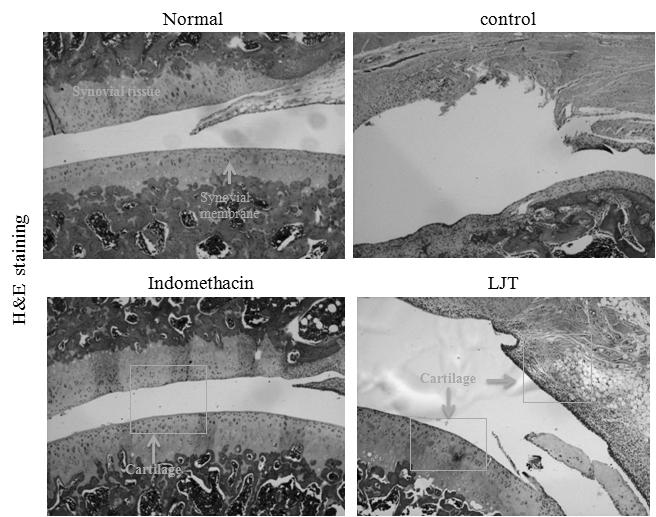 理中湯이골관절염유발생쥐에미치는영향 Fig. 12. Effects of LJT on levels of LTB 4 in the serum of MIA-induced osteoarthritis rats. The levels of LTB 4 were determined using a ELISA system.