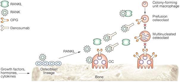 9/30 용하는 osteoprotegerin 고유의작용과유사하다. 즉 RANKL 억제제는체내 osteoprotegerin 의작용을대 신하여골다공증등의파골세포작용을차단한다. www.nature.