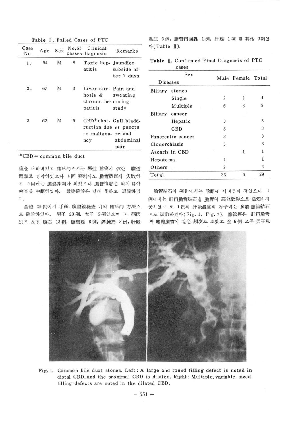 Case No Table ll. Failed Cases of PTC 훌융 lle 3 例, 脫管內回蟲 1 i7jj. 府橫 l 例및其他 2 例였 마 ( Table 111). Age Sex ex No.of Clinical passes diagnosis Remarks 2.