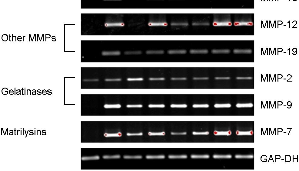 5 μm), or U 73122 (50 ng/ml) for another 24 hrs. cdna was prepared from total RNA extracts and subjected to PCR to amplify MMPs. The PCR products were resolved on a 2% agarose gel.
