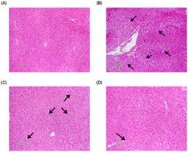 LDL Receptor Knockout Mouse 에서영지추출물의죽상경화증개선효과 21 6. 영지추출물투여를통한간조직의조직병리 학적변화 간조직고정후 H&E염색을실시하여간조직사진을얻었다. 정상군의간조직 (Fig.