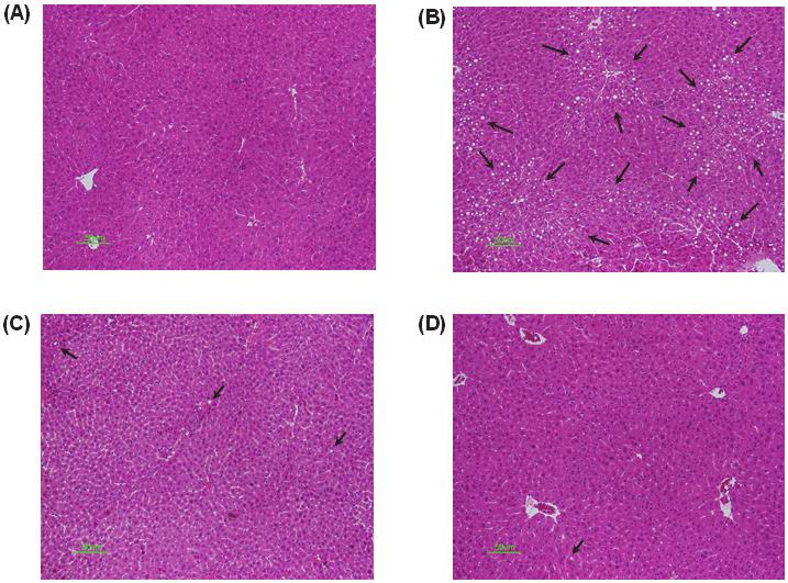 LDL Receptor Knockout Mouse에서 부추추출물의 죽상경화증 예방 효과 17 고 찰 Fig. 5. Effect of Allium tuberosum extract on liver histological profiles in LDLr KO mice.