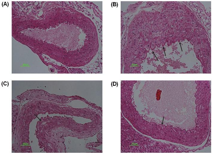 mg/kg body weight treated LDLr KO control mice. (n = 6) The black arrows were means lipid drop and hepatocyte injury. (Original magnification 50), n = 6 mice per group. 6. 동맥의 조직병리학적 변화 동맥의 개선을 직접 확인하고자 H&E 염색을 실시하였다.