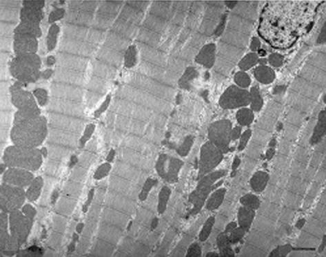 ofibrils appeared intact and formed a regular array. Scale bar indicates 2 µm. M: mitochondria, : myofibrils 유발 5시간후사립체의체적밀도는대조군과비교하여볼때 18.7% 감소되었고 (P<0.001), 상백피투여군은화상군보다 9.