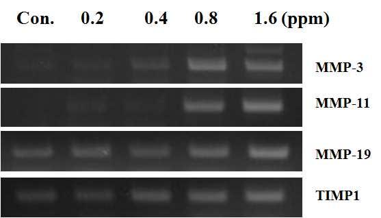 o PCR. o matrix MMP (matrix metalloproteinase). TMIP (tissue inhibitor of matrix metalloproteinase). Fig.4-24.