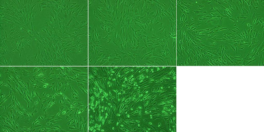 - 김수진외 : 항알레르기약물의효과 - A B C D E Figure 9. Phase-contrast microscopic photographs of conjunctival cells after -hour exposure to (A) (B) % SCD-P, (C) % Patanol, (D) % Zaditen, (E) % Azelan.
