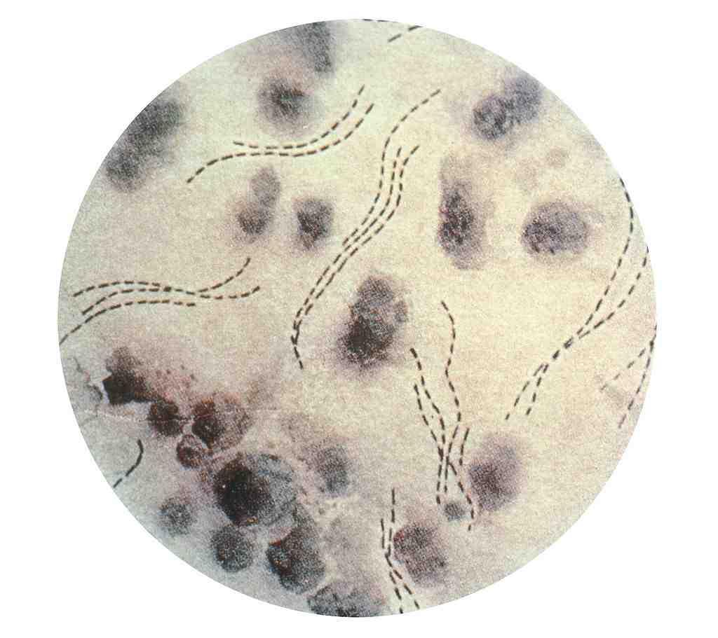 2017 병원체생물안전정보집 ( 제 2, 3, 4 위험군 ) 39 Haemophilus ducreyi 위험군 : 제 2위험군 국내범주 :- 특성 :Pasteurellaceae 과, 그람음성, 짧은막대균, 포자형성안함, 조건무산소성 출처 :CDC 병원성및감염증상 잠복기 :1~35일 성기나회음부의통증성궤양성질환인연성하감 (chancroid) 를유발함