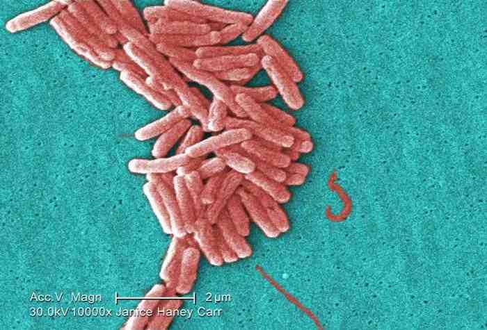 2017 병원체생물안전정보집 ( 제 2, 3, 4 위험군 ) 44 Legionella spp.