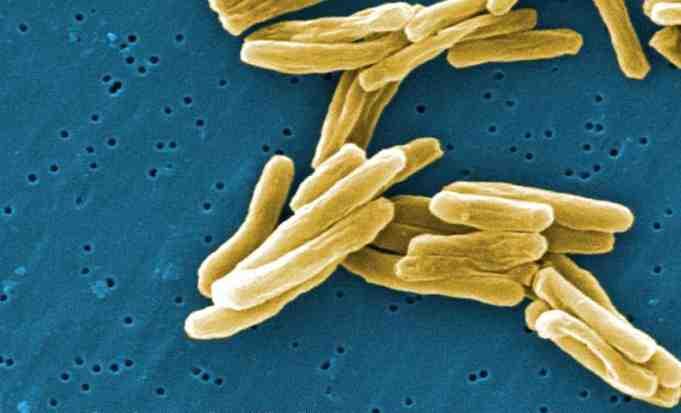 세균 01 49 Mycobacterium tuberculosis complex (M. africanum, M. bovis, M. tuberculosis 등 ) 위험군 : 제 3위험군 (BCG주제외 ) 국내범주 :- 특성 :Mycobacteriaceae과, 막대균, 운동성없음.