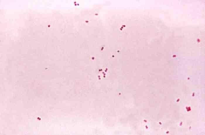 2017 병원체생물안전정보집 ( 제 2, 3, 4 위험군 ) 53 Neisseria meningitidis 위험군 : 제 2위험군 국내범주 :- 특성 :Neisseriaceae 과, 그람음성, 쌍알균, 운동성없음, 산소성 출처 :CDC/ Dr.