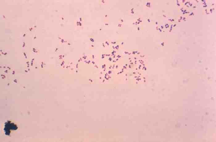 2017 병원체생물안전정보집 ( 제 2, 3, 4 위험군 ) 60 Rhodococcus equi 위험군 : 제 2위험군 국내범주 :- 특성 :Nocardiaceae과, 그람양성, 짧은막대균, 아포형성하지않음, 조건무산소성 출처 :CDC/ Regina Linder: Hunter College, New York, New York, USA 병원성및감염증상